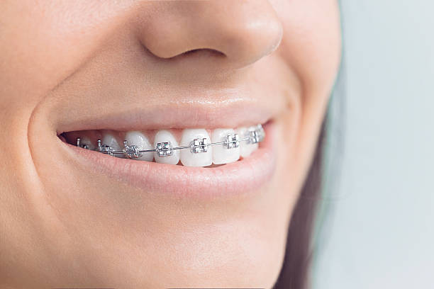 Best Dental Inlays and Onlays  in Farmerville, LA